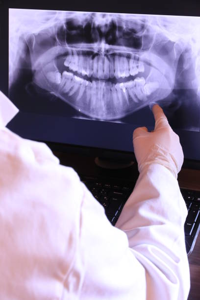Best Broken or Chipped Tooth Repair in Pce, LA