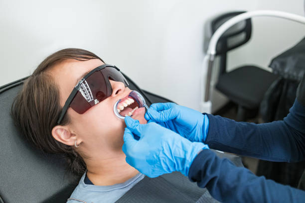 Best Emergency Wisdom Tooth Extraction in Pce, LA
