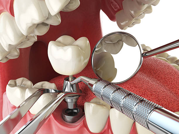 Best 24-Hour Emergency Dental Care in Pce, LA